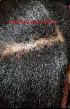 Load image into Gallery viewer, Scalp healing detox treatment with protective style and no trim.  All appointments will require a deposit. No refund. The protective style is $95, the detox treatment is $20.
